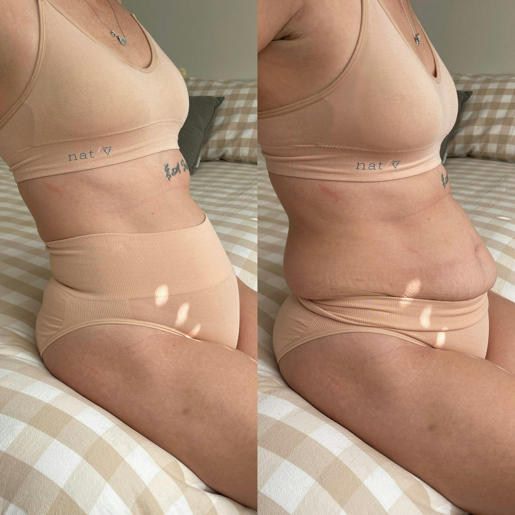 CHICHI SUPPORT BRIEF